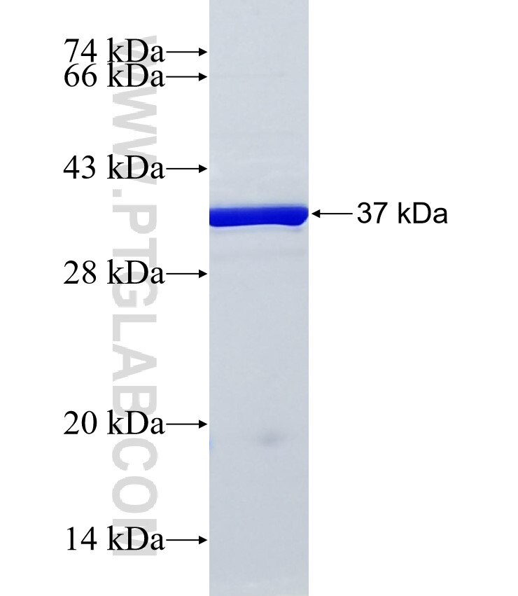 PDZRN3 fusion protein Ag24465 SDS-PAGE PDZRN3 fusion protein Ag24465 SDS-PAGE