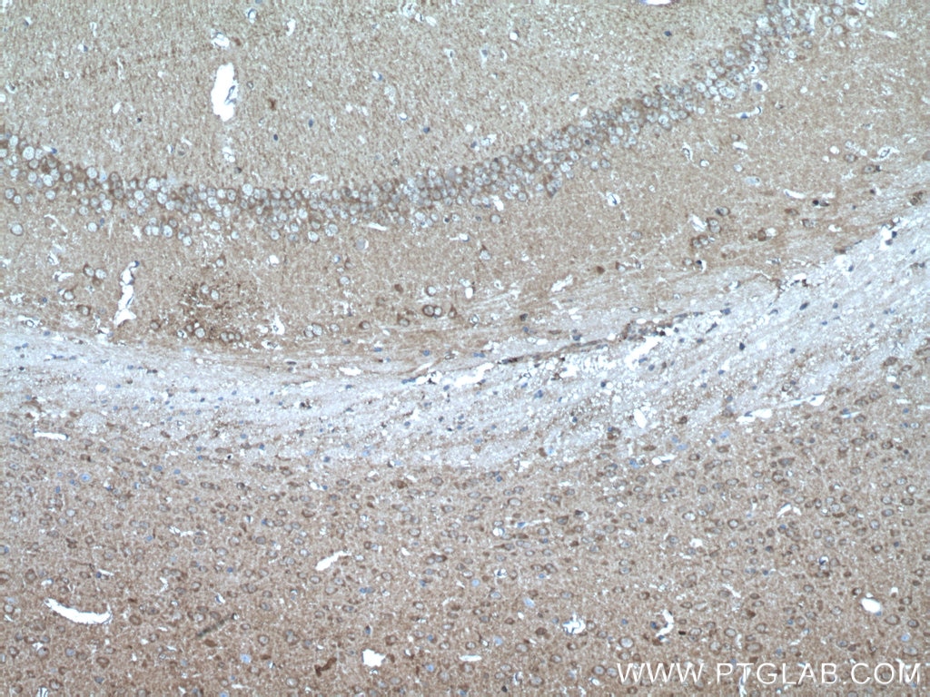 Immunohistochemistry (IHC) staining of mouse brain tissue using PEA15 Polyclonal antibody (21446-1-AP)