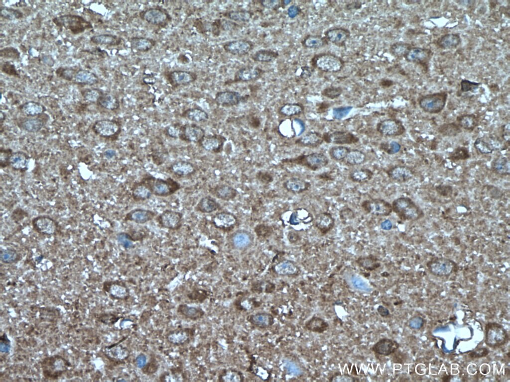 Immunohistochemistry (IHC) staining of mouse brain tissue using PEA15 Polyclonal antibody (21446-1-AP)