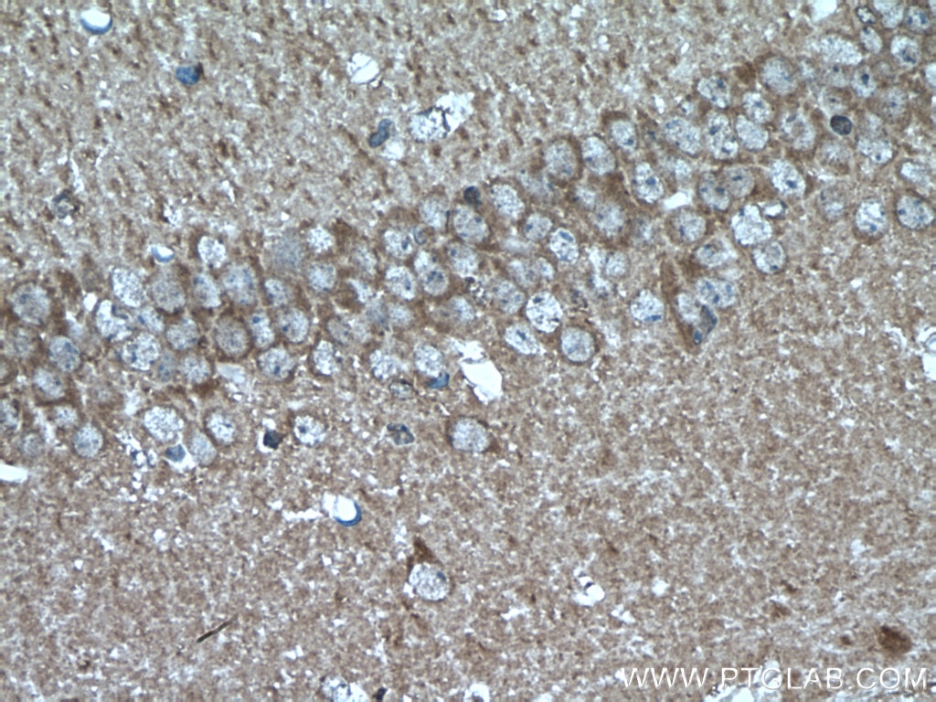 Immunohistochemistry (IHC) staining of mouse brain tissue using PEA15 Polyclonal antibody (21446-1-AP)