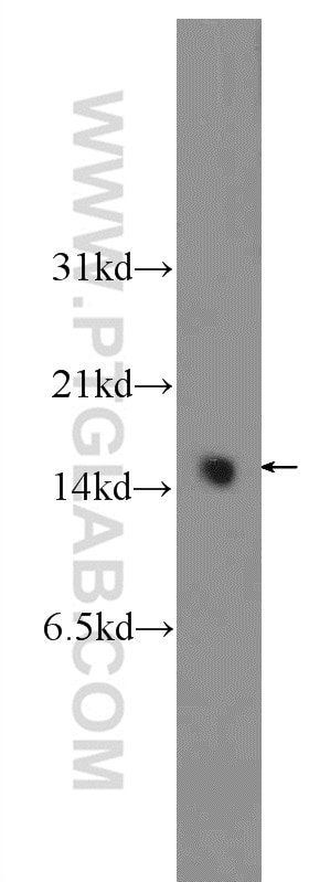 Western Blot (WB) analysis of fetal human brain tissue using PEA15 Polyclonal antibody (21446-1-AP)