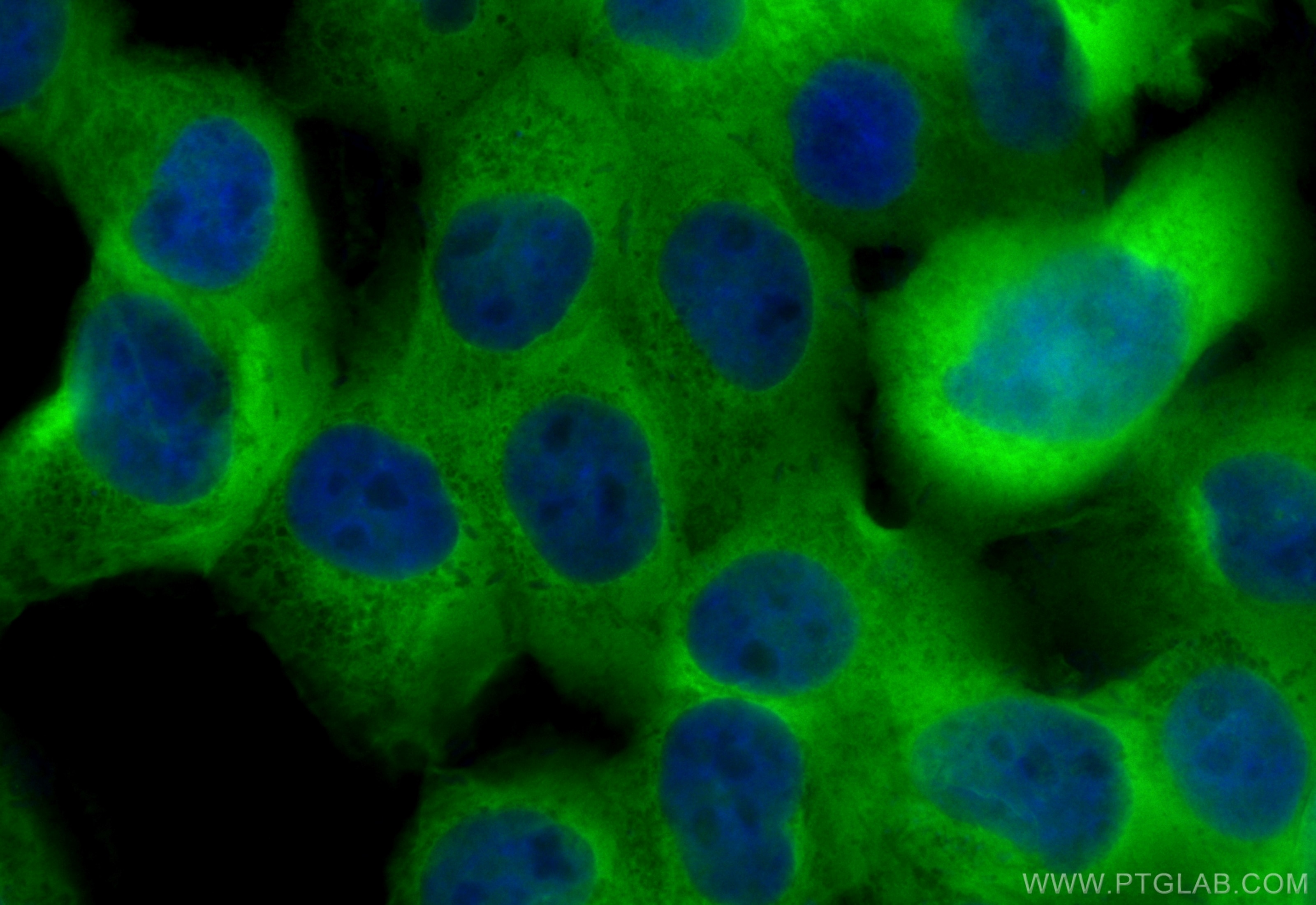 Immunofluorescence (IF) / fluorescent staining of A431 cells using CoraLite® Plus 488-conjugated PEA15 Recombinant an (CL488-83958-3)