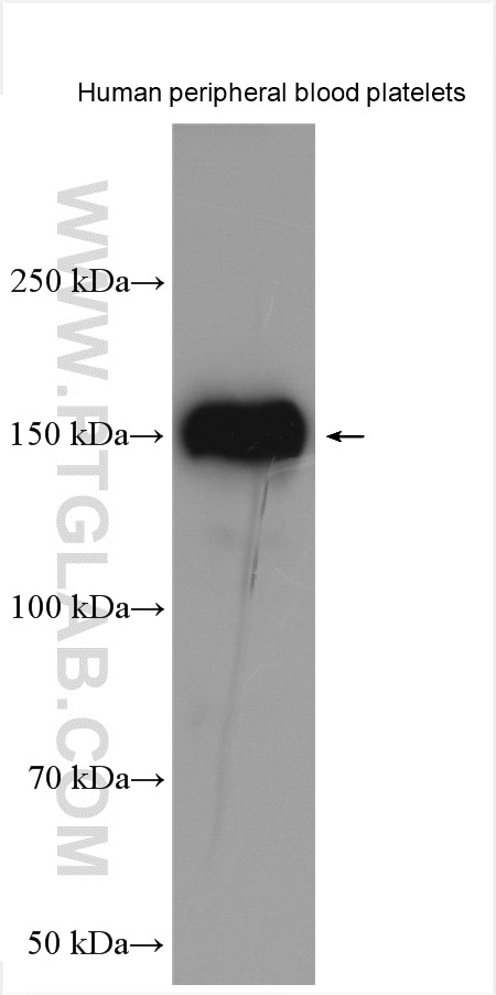 Western Blot (WB) analysis of various lysates using PEAR1 Polyclonal antibody (28086-1-AP)