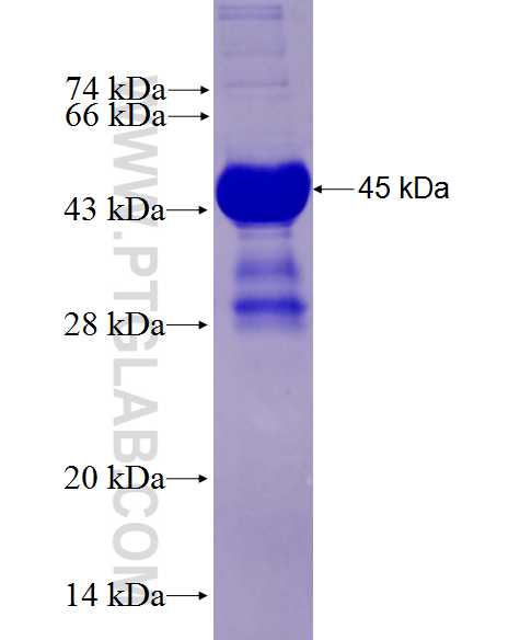 PEAR1 fusion protein Ag27978 SDS-PAGE