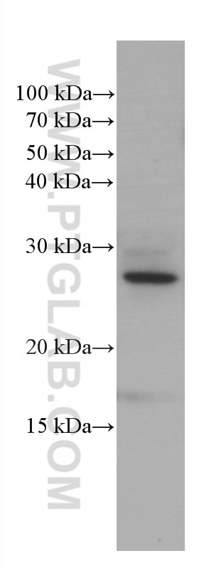 WB analysis of Neuro-2a using 66438-1-Ig