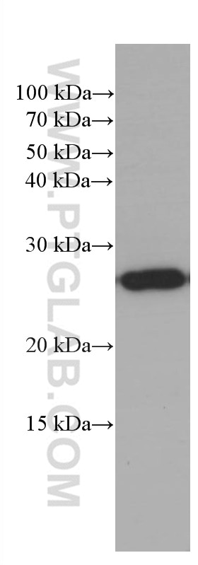 Western Blot (WB) analysis of fetal human brain tissue using PEBP1 Monoclonal antibody (66438-1-Ig)