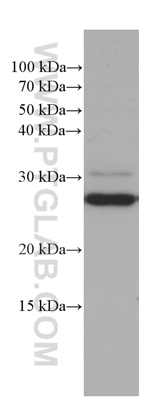 Western Blot (WB) analysis of rat brain tissue using PEBP1 Monoclonal antibody (66438-1-Ig)