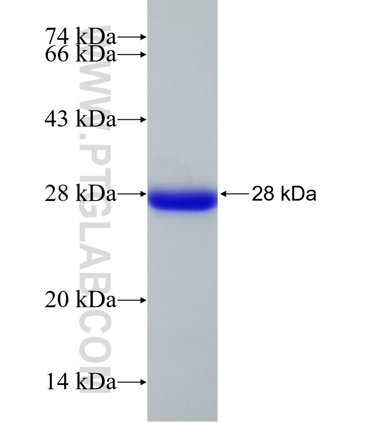 PEBP4 fusion protein Ag32991 SDS-PAGE