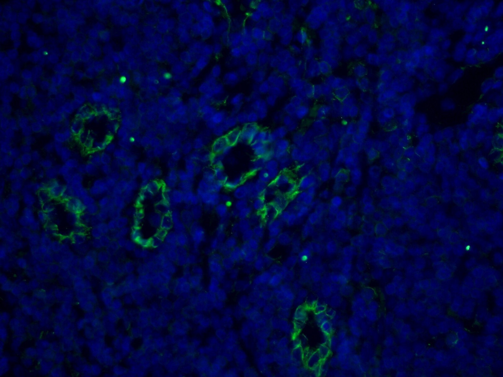 Immunofluorescence (IF) / fluorescent staining of human tonsillitis tissue using CD31 Monoclonal antibody (66065-1-Ig)