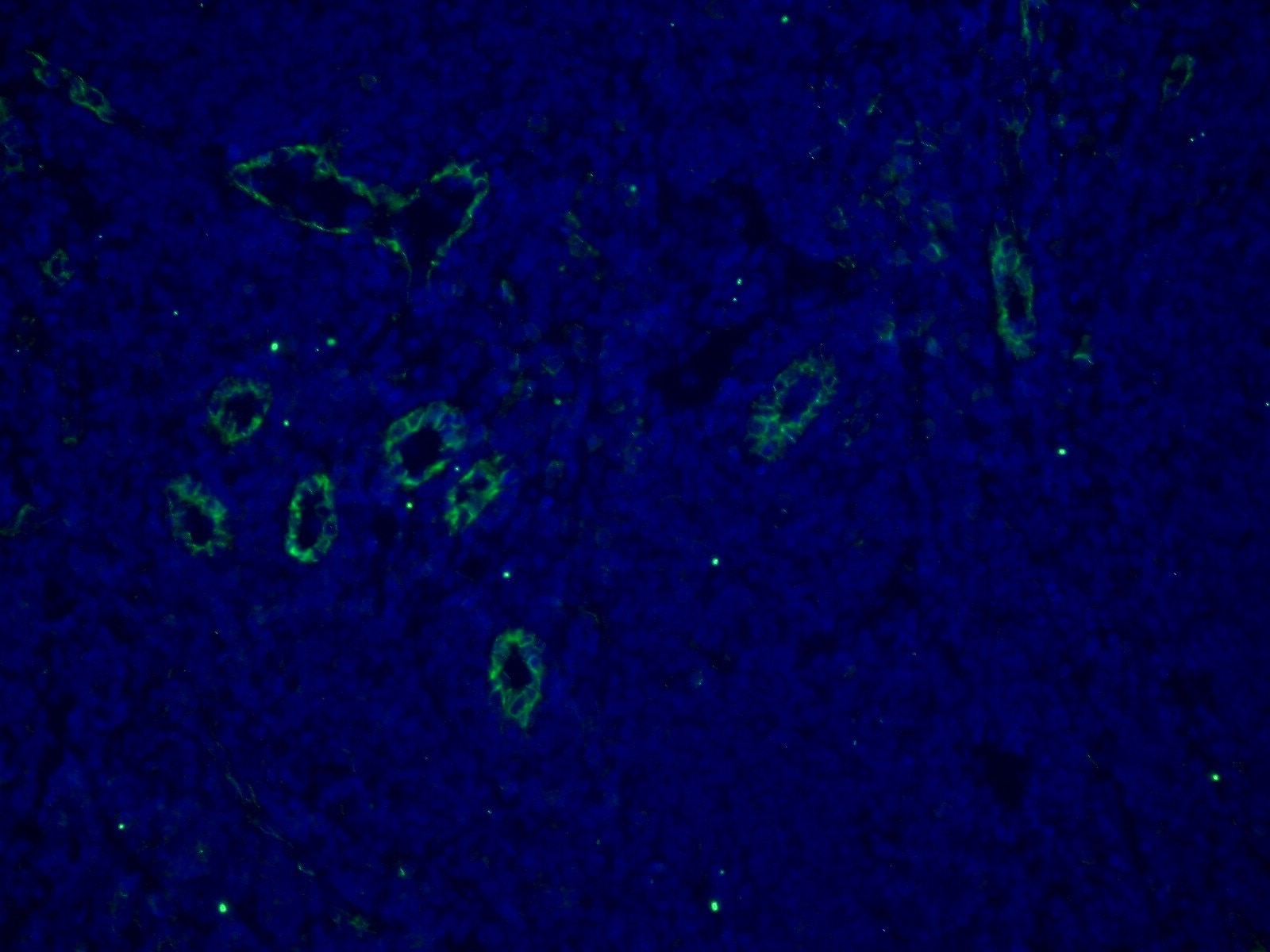 Immunofluorescence (IF) / fluorescent staining of human tonsillitis tissue using CD31 Monoclonal antibody (66065-1-Ig)