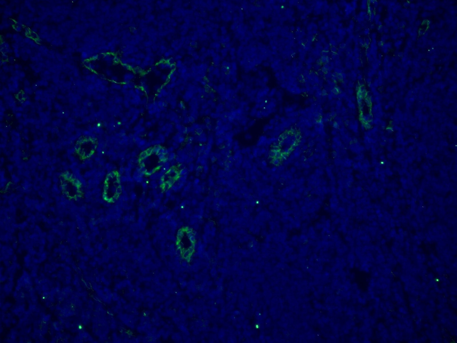 IF Staining of human tonsillitis using 66065-1-Ig