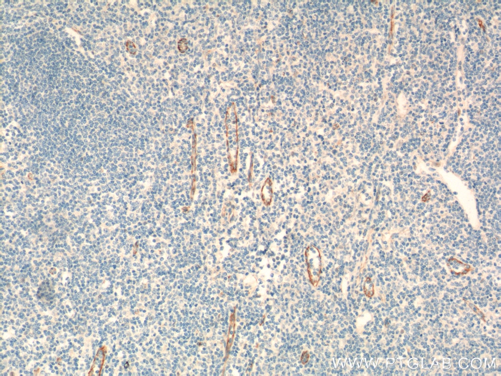 CD31 Monoclonal antibody