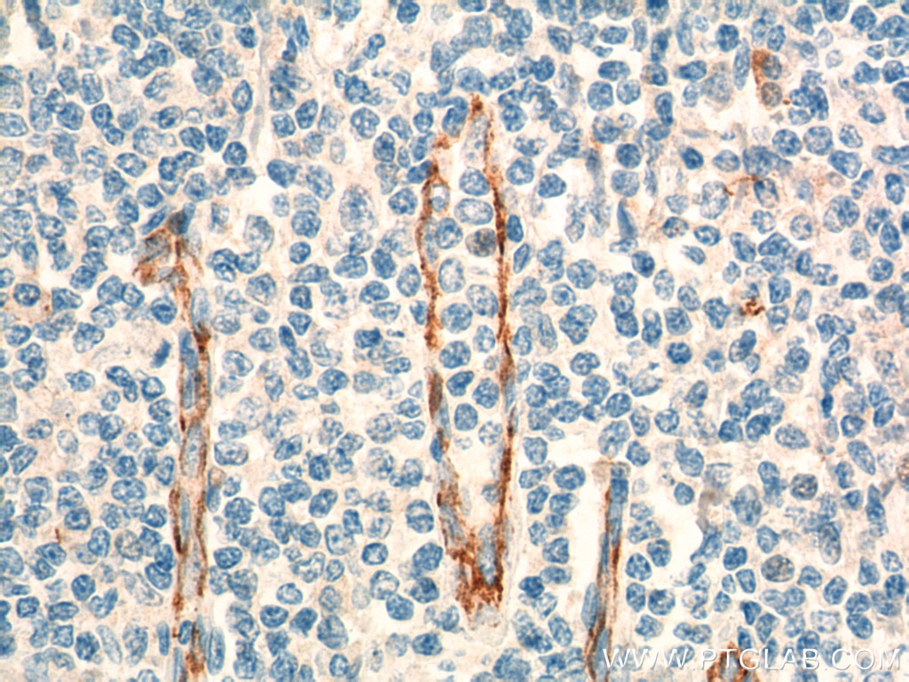 CD31 Monoclonal antibody