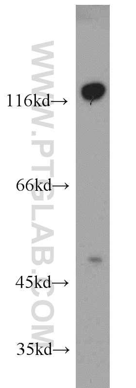 Western Blot (WB) analysis of Jurkat cells using CD31 Monoclonal antibody (66065-1-Ig)