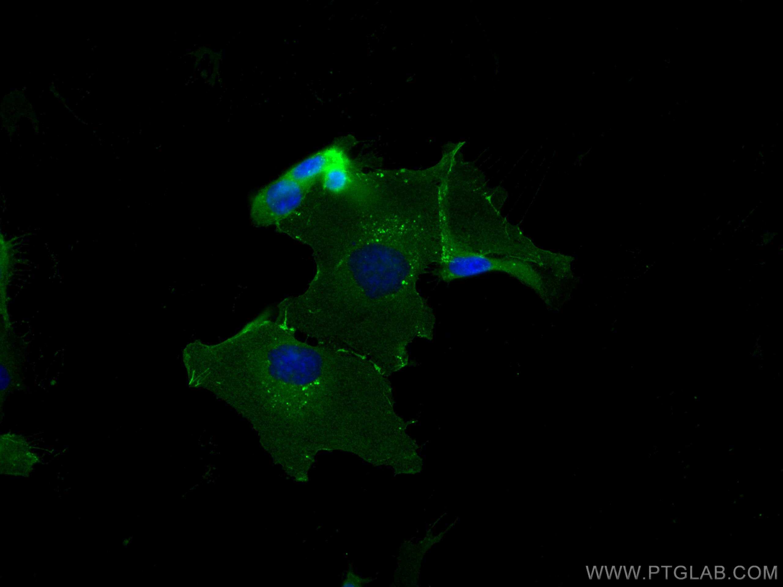 Immunofluorescence (IF) / fluorescent staining of HUVEC cells using CD31 Polyclonal antibody (11265-1-AP)