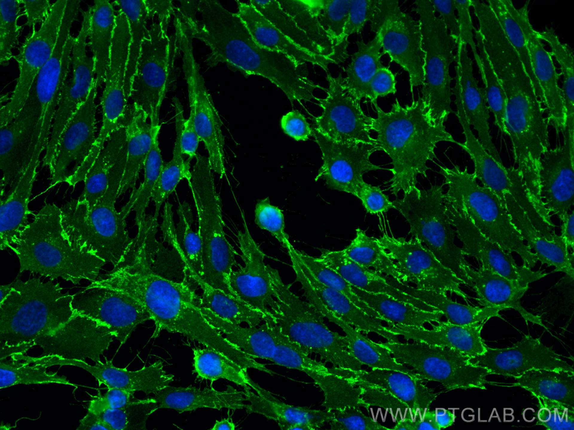 Immunofluorescence (IF) / fluorescent staining of HUVEC cells using CD31 Polyclonal antibody (11265-1-AP)