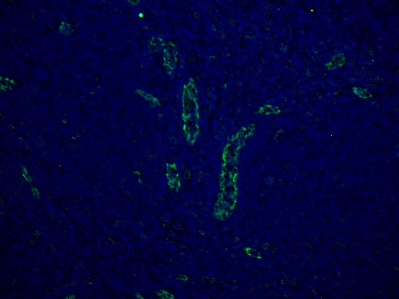 Immunofluorescence (IF) / fluorescent staining of human tonsillitis tissue using CD31 Polyclonal antibody (11265-1-AP)