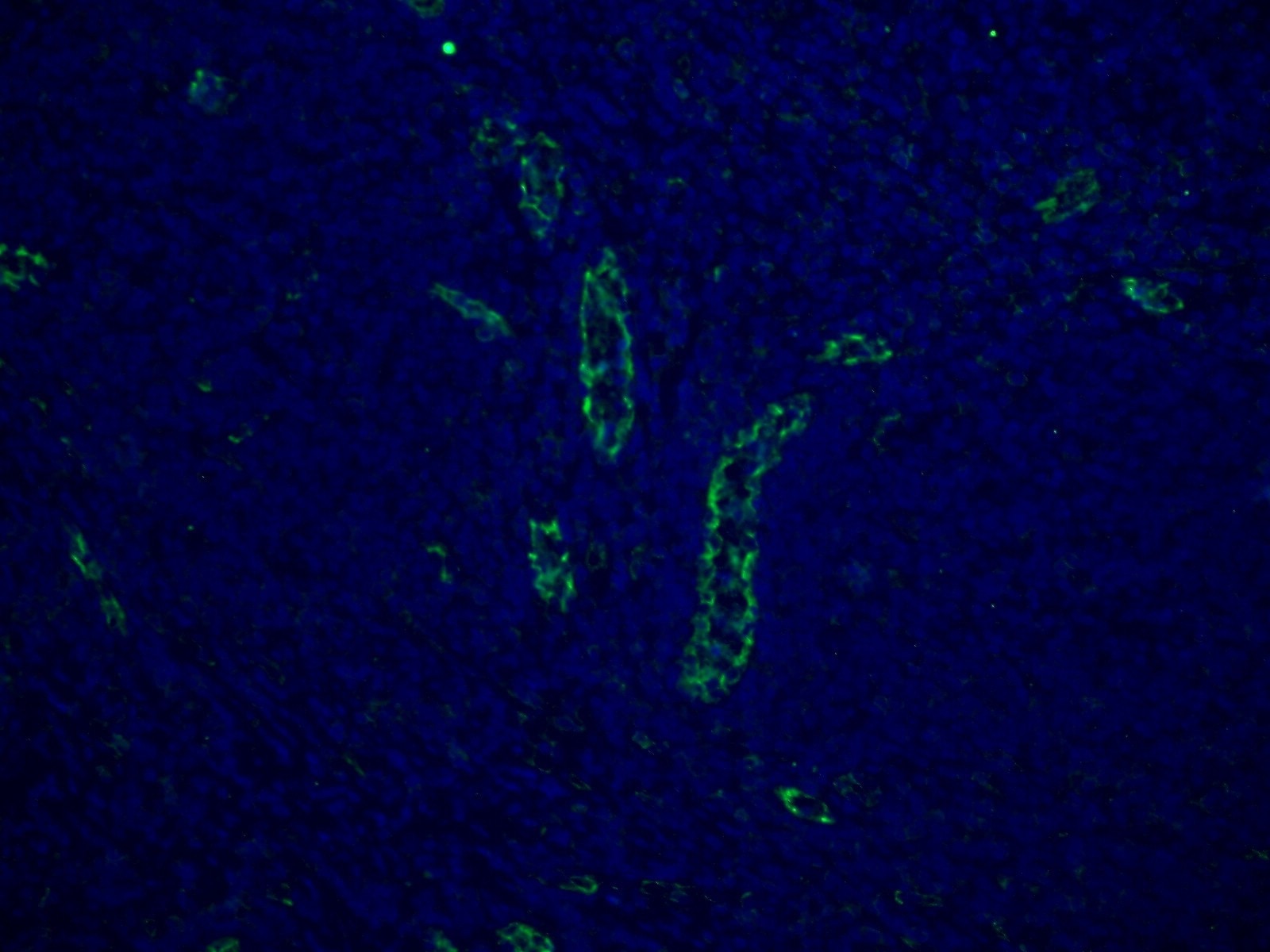 IF Staining of human tonsillitis using 11265-1-AP