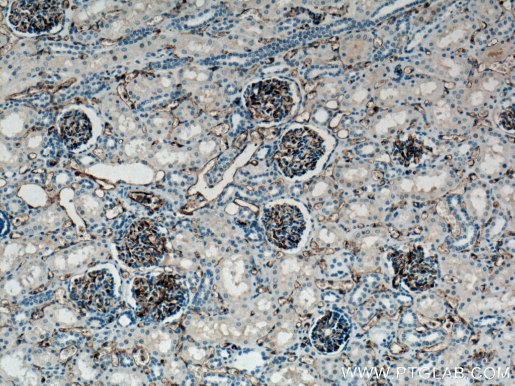 Immunohistochemistry (IHC) staining of human kidney tissue using CD31 Polyclonal antibody (11265-1-AP)