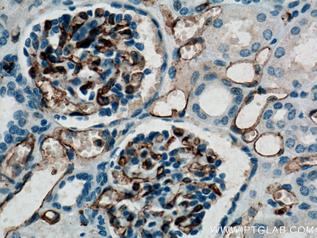 IHC staining of human kidney using 11265-1-AP