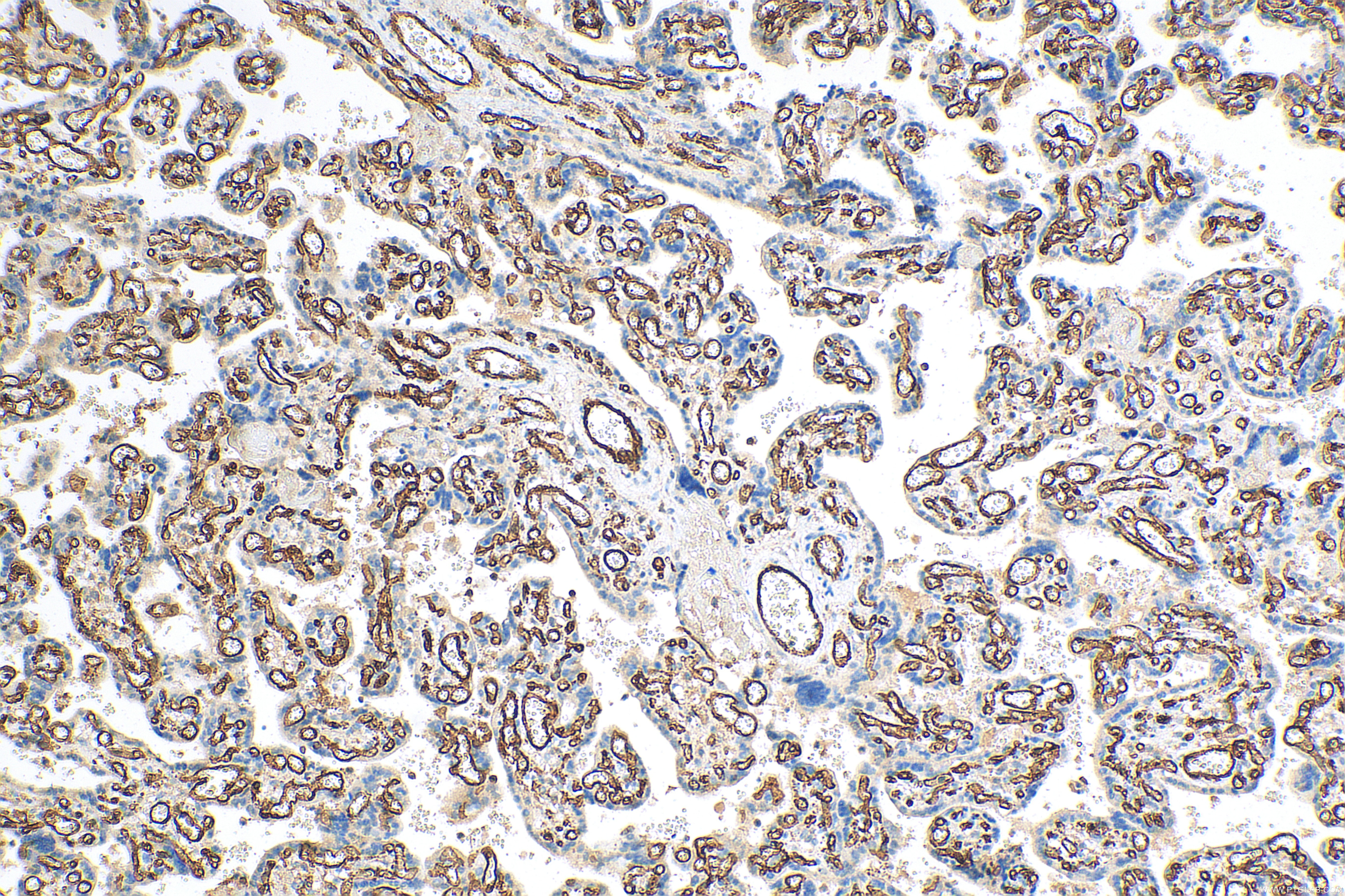 Immunohistochemistry (IHC) staining of human placenta tissue using CD31 Polyclonal antibody (11265-1-AP)