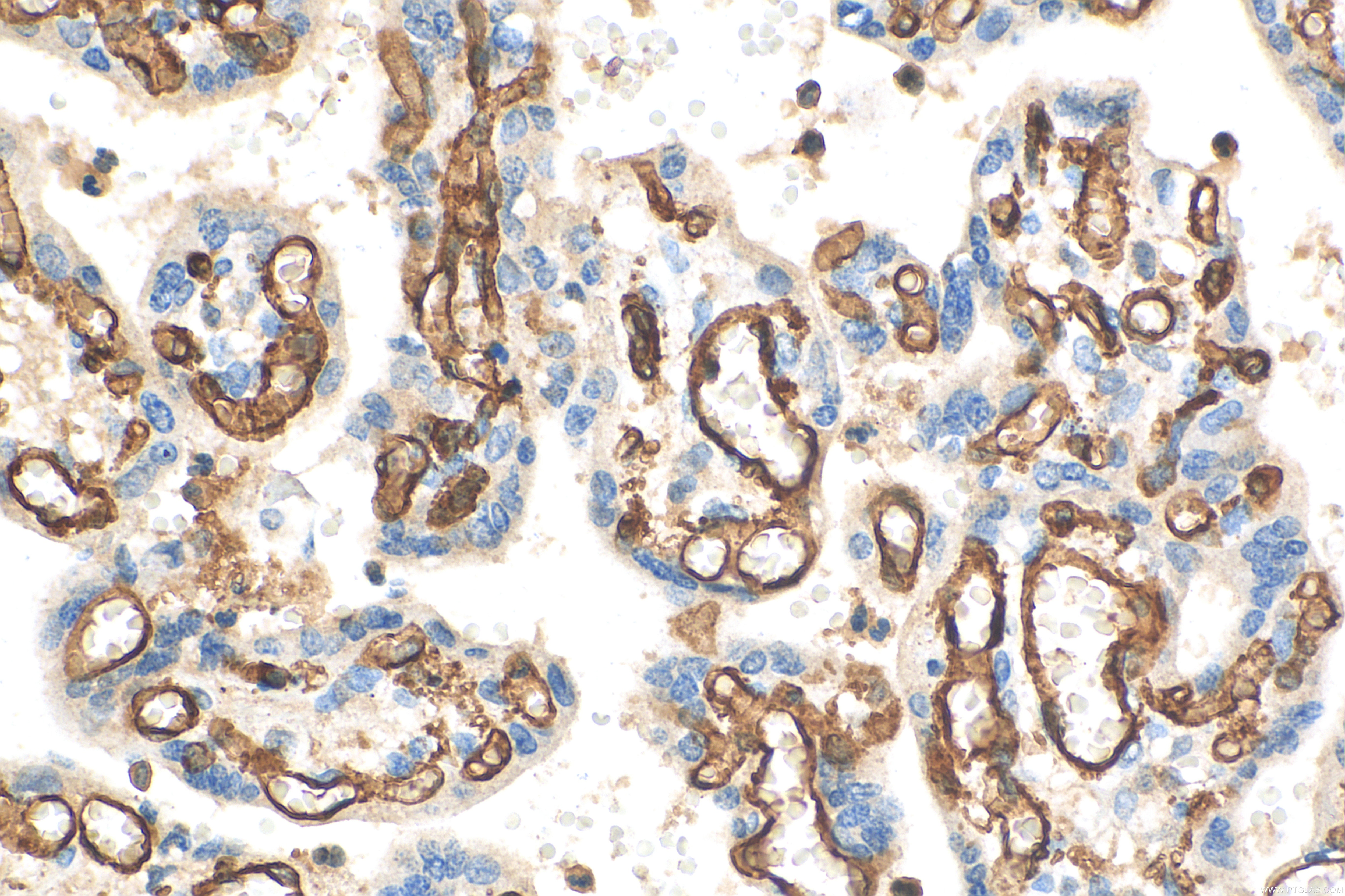 Immunohistochemistry (IHC) staining of human placenta tissue using CD31 Polyclonal antibody (11265-1-AP)