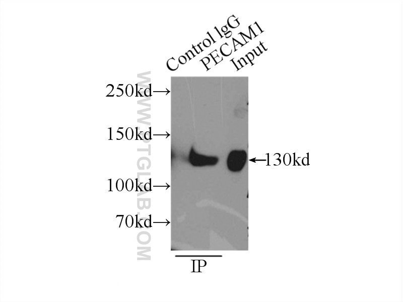 Immunoprecipitation (IP) experiment of Jurkat cells using CD31 Polyclonal antibody (11265-1-AP)