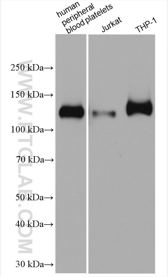 Western Blot (WB) analysis of various lysates using CD31 Polyclonal antibody (11265-1-AP)