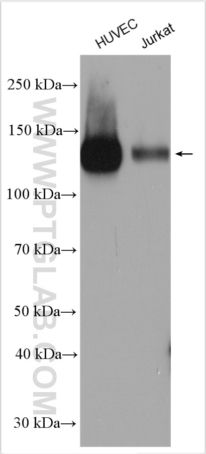 Western Blot (WB) analysis of HUVEC cells using CD31 Polyclonal antibody (11265-1-AP)