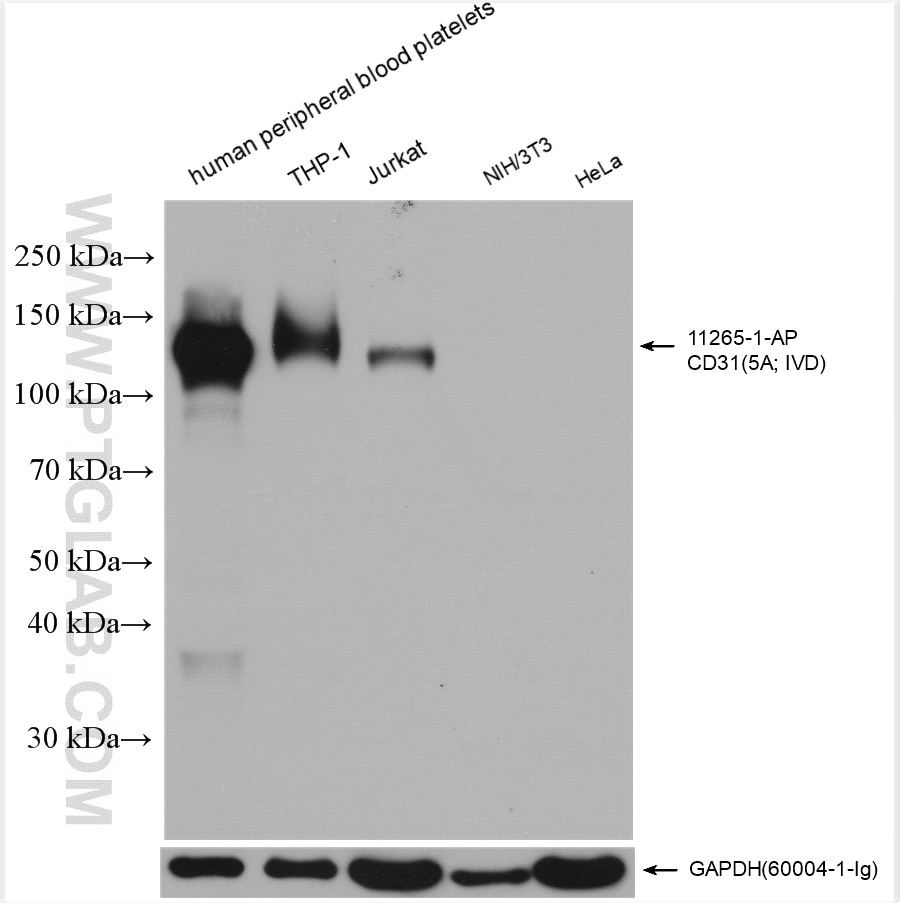 Western Blot (WB) analysis of various lysates using CD31 Polyclonal antibody (11265-1-AP)