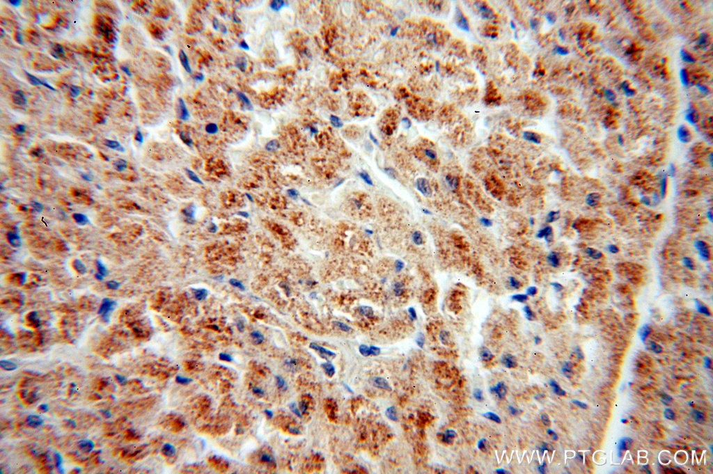 Immunohistochemistry (IHC) staining of human heart tissue using PECI Polyclonal antibody (20383-1-AP)