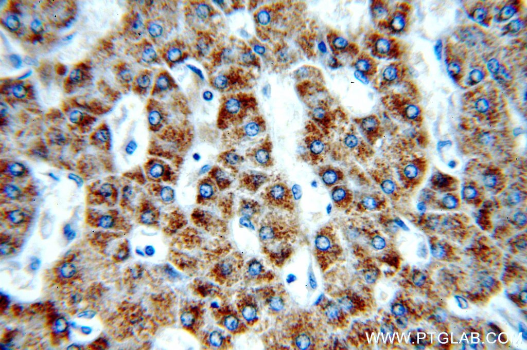 Immunohistochemistry (IHC) staining of human hepatocirrhosis tissue using PECI Polyclonal antibody (20383-1-AP)