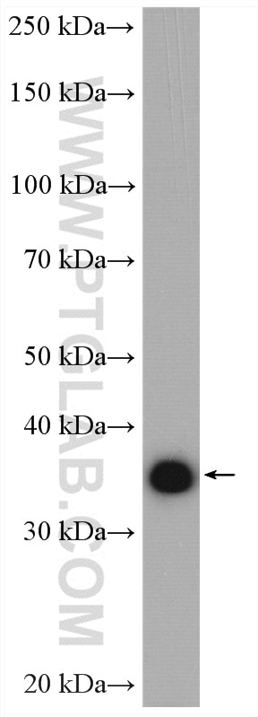 Western Blot (WB) analysis of human placenta tissue using PECI Polyclonal antibody (20383-1-AP)