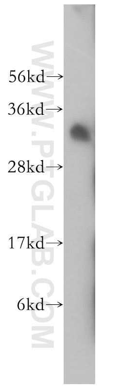 Western Blot (WB) analysis of human testis tissue using PECR Polyclonal antibody (14901-1-AP)