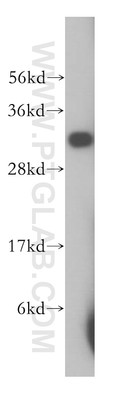 Western Blot (WB) analysis of human kidney tissue using PECR Polyclonal antibody (14901-1-AP)