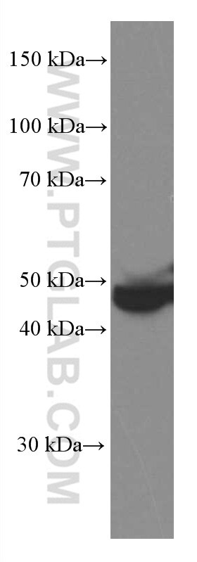 WB analysis of human plasma using 66554-1-Ig