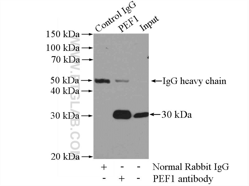 Immunoprecipitation (IP) experiment of HEK-293 cells using PEF1 Polyclonal antibody (10151-1-AP)