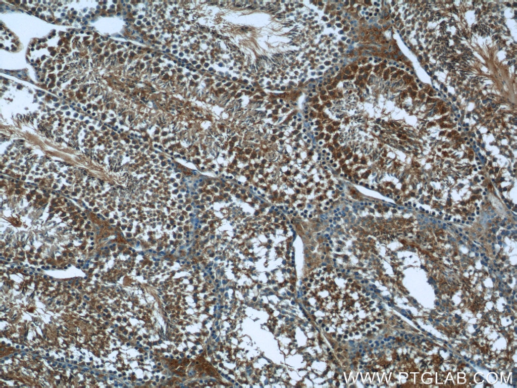 Immunohistochemistry (IHC) staining of mouse testis tissue using PEG10 Polyclonal antibody (14412-1-AP)