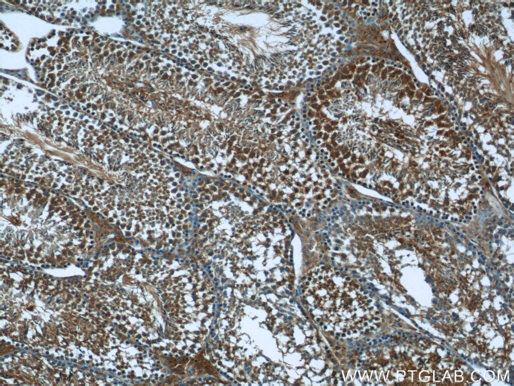 Immunohistochemistry (IHC) staining of mouse testis tissue using PEG10 Polyclonal antibody (14412-1-AP)