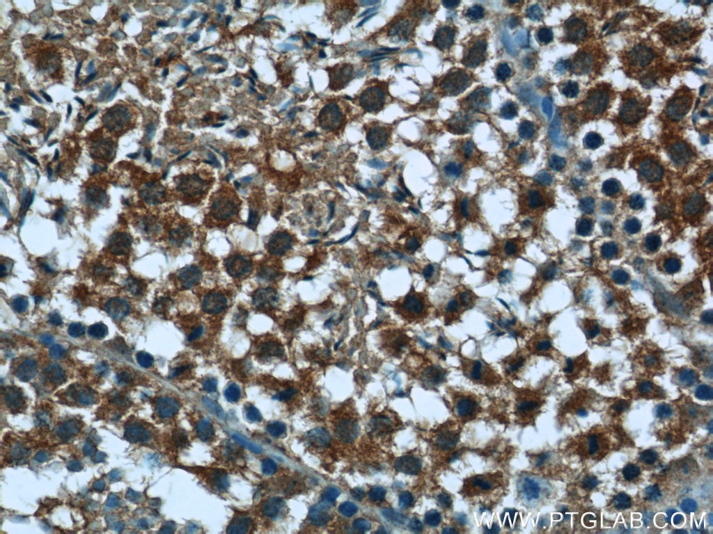 Immunohistochemistry (IHC) staining of mouse testis tissue using PEG10 Polyclonal antibody (14412-1-AP)