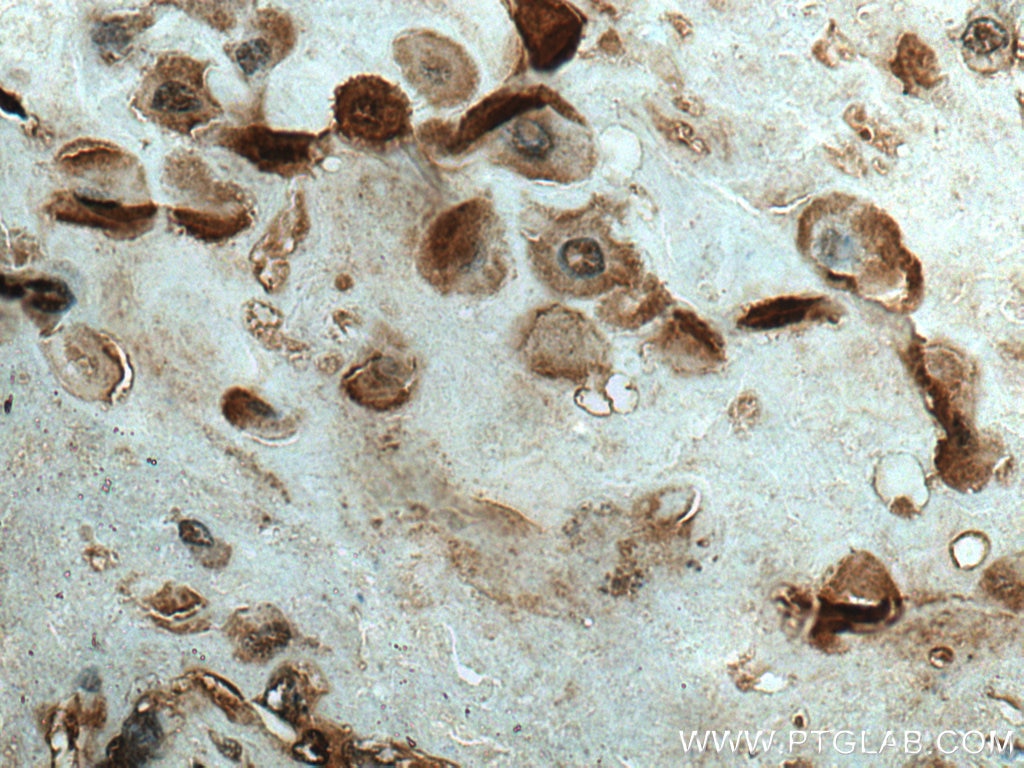 Immunohistochemistry (IHC) staining of human placenta tissue using PEG10 Polyclonal antibody (14412-1-AP)