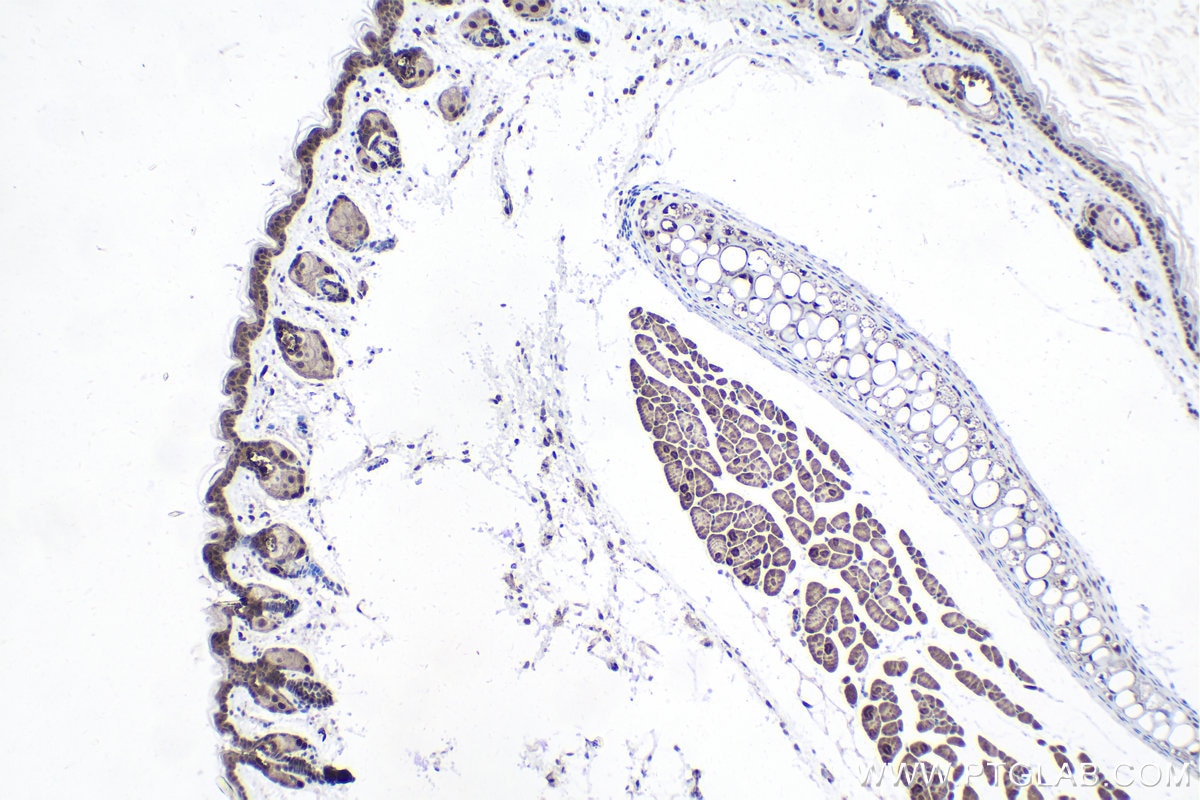 Immunohistochemistry (IHC) staining of mouse skin tissue using PEG10 Polyclonal antibody (14412-1-AP)