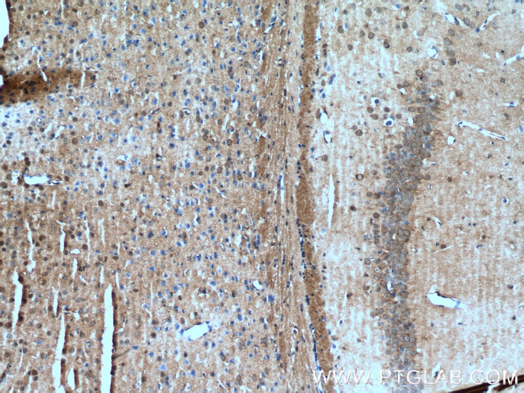Immunohistochemistry (IHC) staining of mouse brain tissue using PEG10 Polyclonal antibody (14412-1-AP)