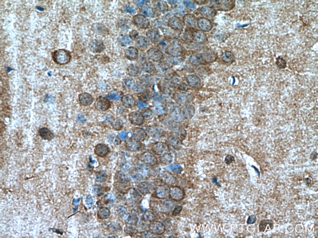 Immunohistochemistry (IHC) staining of mouse brain tissue using PEG10 Polyclonal antibody (14412-1-AP)