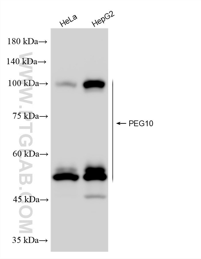 Various lysates were subjected to SDS PAGE followed by western blot with 86928-4-RR (PEG10 antibody) at dilution of 1:10000 incubated at room temperature for 1.5 hours. Western Blot (WB) analysis of various lysates using PEG10 Recombinant monoclonal antibody (86928-4-RR)
