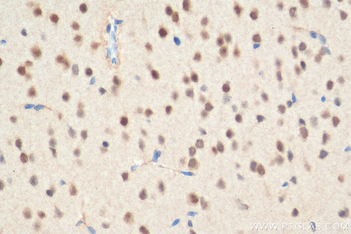 Immunohistochemistry (IHC) staining of mouse brain tissue using PEG3 Polyclonal antibody (23569-1-AP)