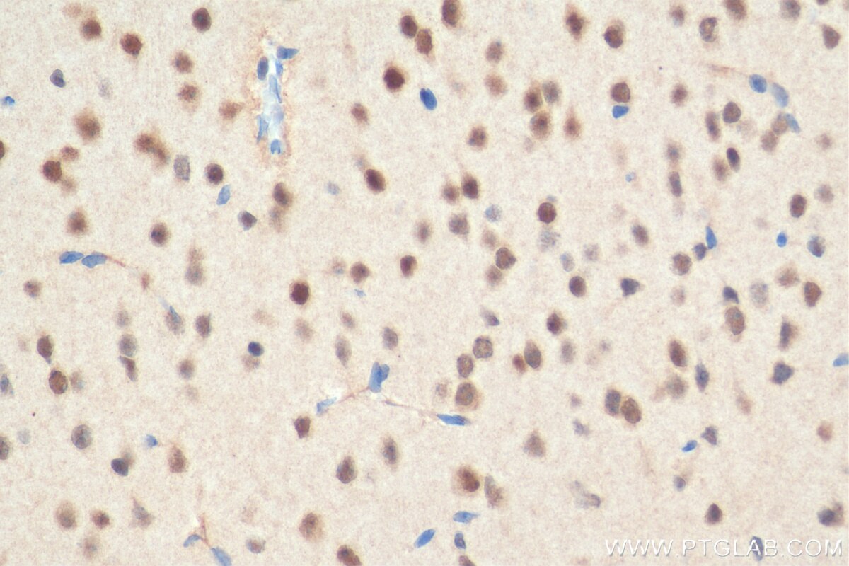 IHC staining of mouse brain using 23569-1-AP