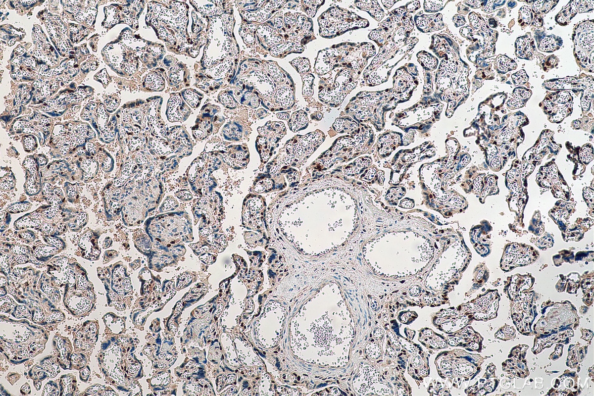 Immunohistochemistry (IHC) staining of human placenta tissue using PEG3 Polyclonal antibody (23569-1-AP)