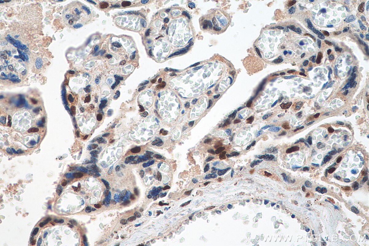 Immunohistochemistry (IHC) staining of human placenta tissue using PEG3 Polyclonal antibody (23569-1-AP)