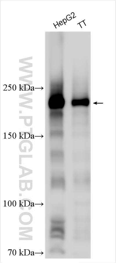 Western Blot (WB) analysis of various lysates using PEG3 Polyclonal antibody (23569-1-AP)